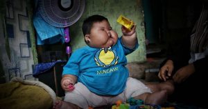 Bisakah Anak yang Sudah Obesitas Tetap Tumbuh dan Berkembang Secara Optimal