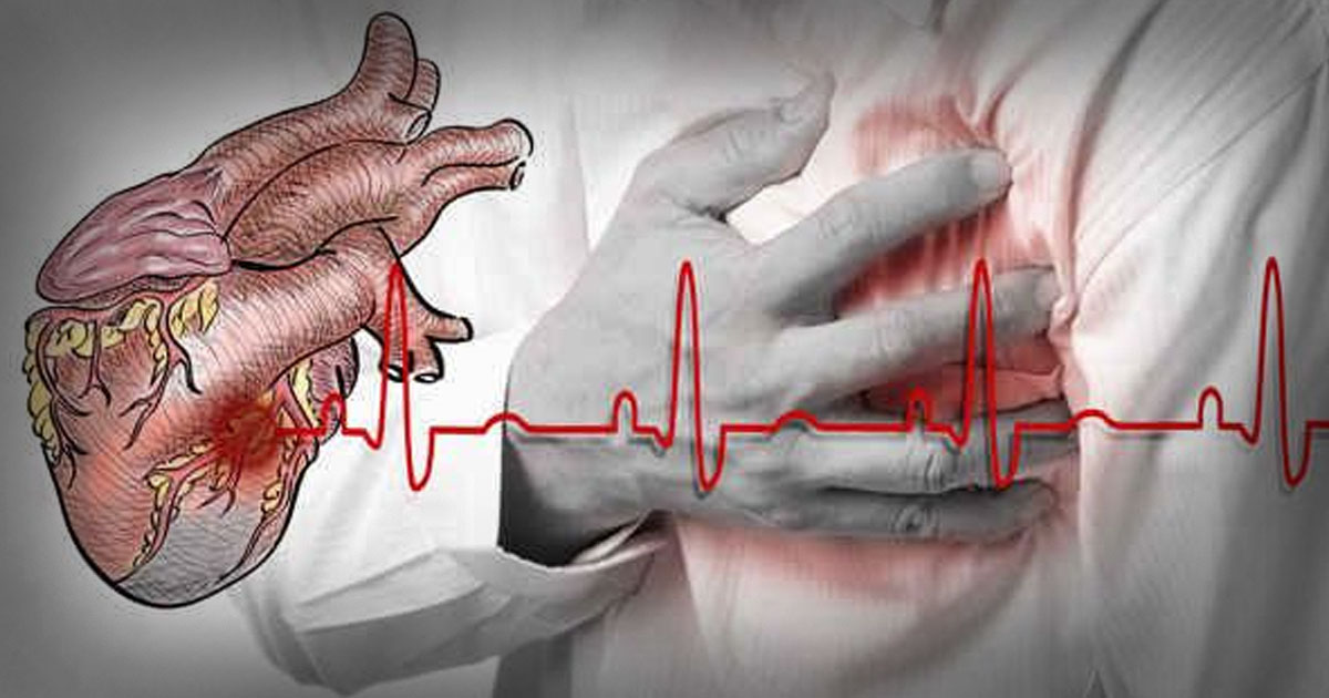 Kasus Aritmia pada Usia Muda Meningkat di Indonesia