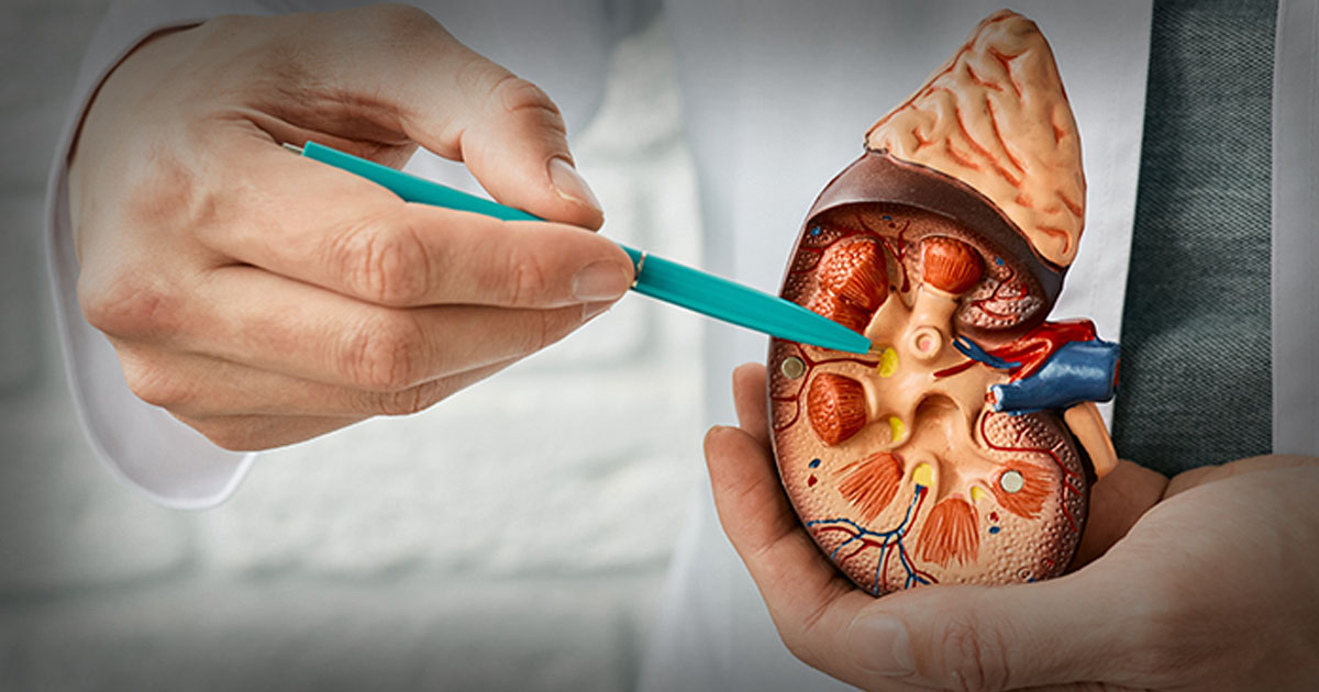 Lonjakan Kasus Kanker Ginjal Diprediksi pada 2050, Ini Faktor Risiko yang Perlu Diwaspadai